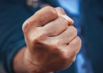 У Бучі через заклик розмовляти українською побили жінку (ФОТО)