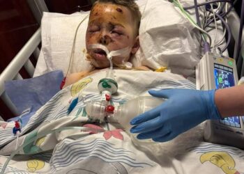 Хлопчик, який 18 травня постраждав від атаки дронів у Василькові, перебуває в “Охматдиті”