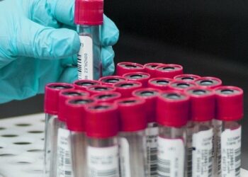 На Обухівщині запрацює мобільна амбулаторії