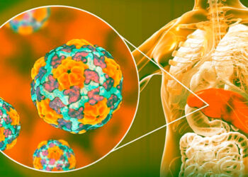 В одному з районів Києва зафіксовано спалах гепатиту A