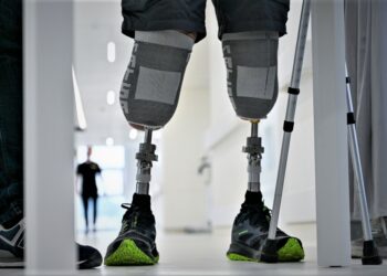 Сучасне протезування та допоміжні засоби реабілітації для всіх, хто потребує за кошт держави